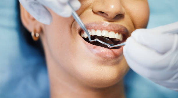 Best Pediatric Emergency Dentist in San Marcos, CA