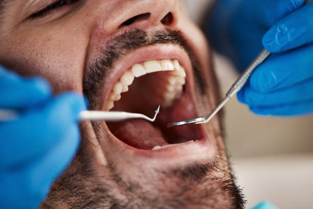 Best Pediatric Emergency Dentist in San Marcos, CA